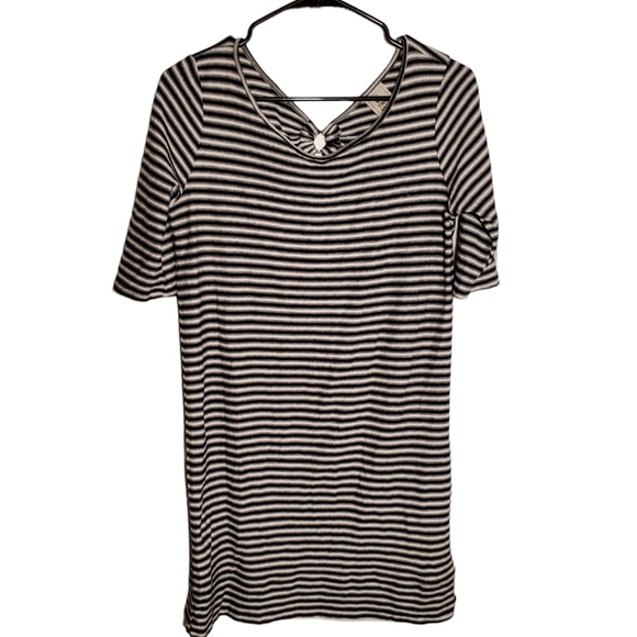 WE the Free Striped Dress with Open Back Detail - Picture 1 of 8